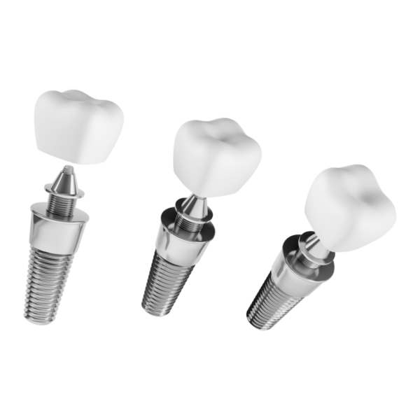 Dental Inplants