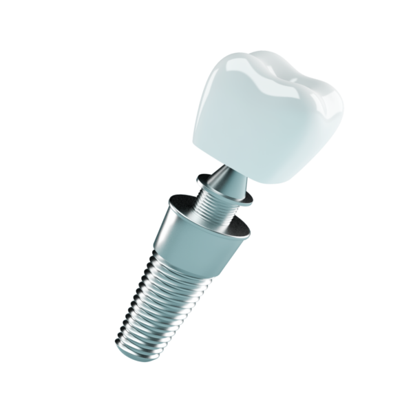 Dental Inplants - Image 2